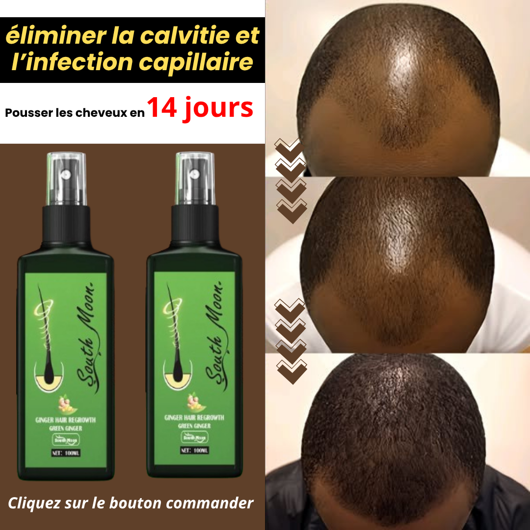 Spray Pousse Cheveux Ultra Puissant (100% Naturel)