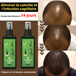 Charger l&#39;image dans la galerie, Spray Pousse Cheveux Ultra Puissant (100% Naturel)
